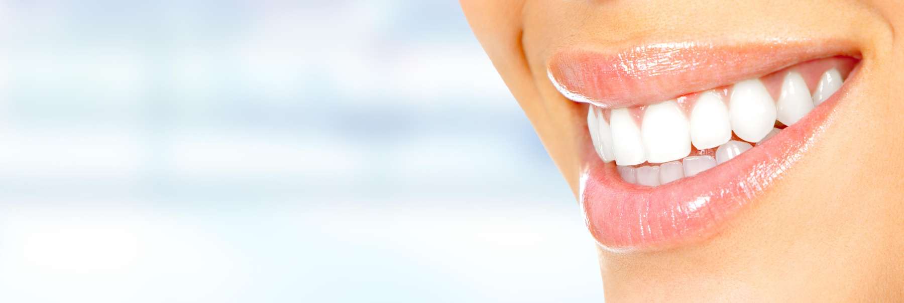 woman smiling with a bright white smile in edwardsville