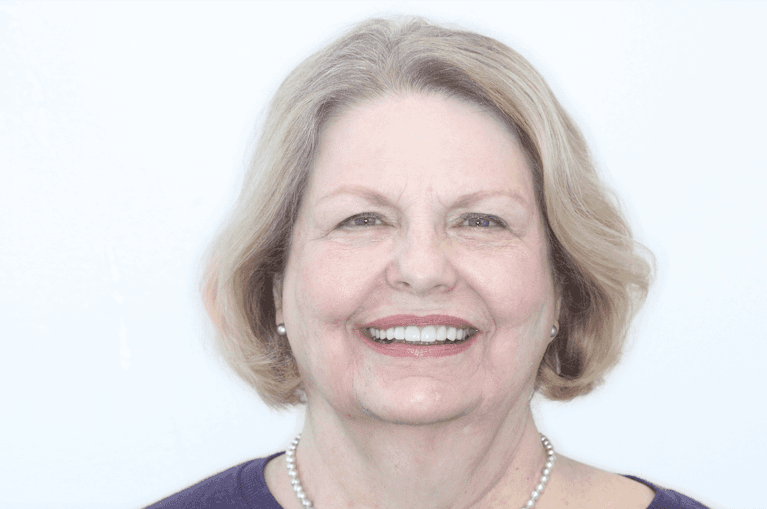 after smile reconstruction in edwardsville il 