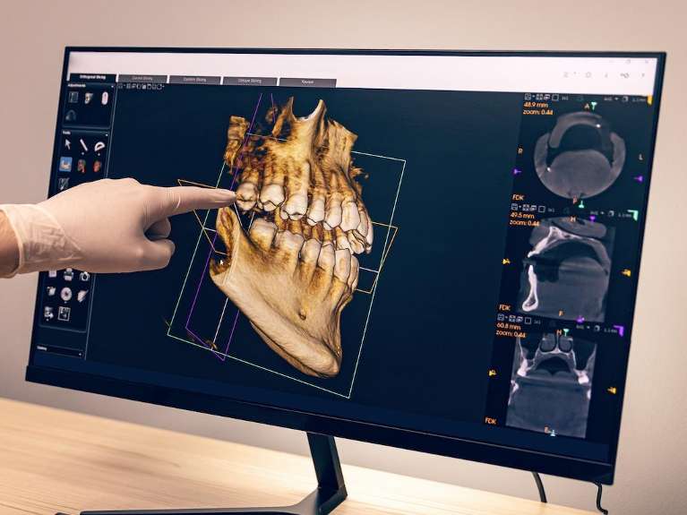 Cone Beam Computed Tomography (CBCT)