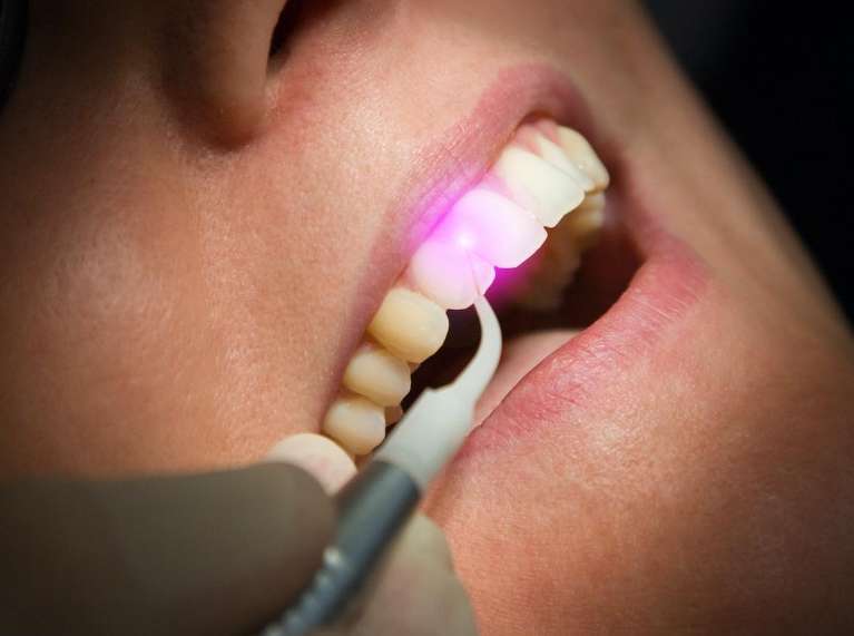 Laser Dentistry in Edwardsville