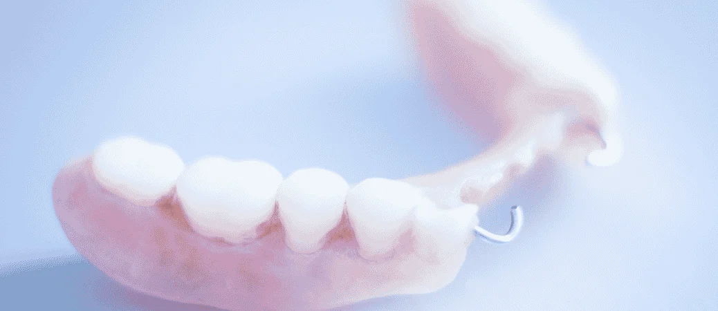 Should You Choose a Fixed Bridge or Partial Denture
