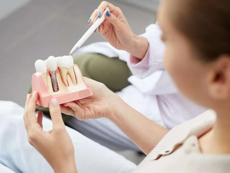 5 Top Reasons You Should Consider Dental Implants