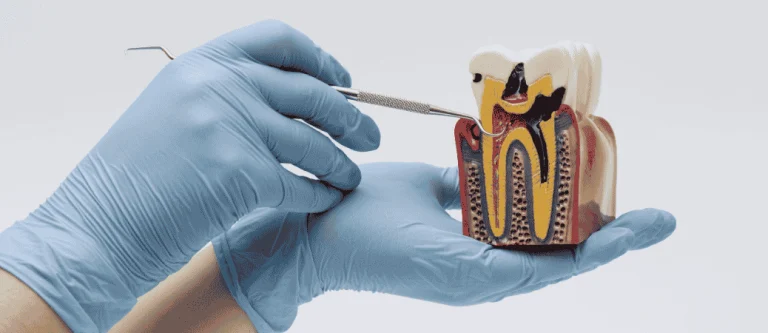 root canal vs tooth extraction
